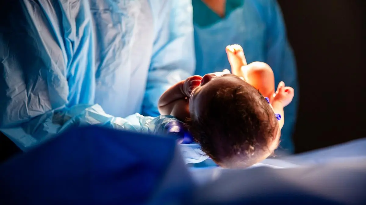 Jammu and Kashmir leads India in private C-section rates