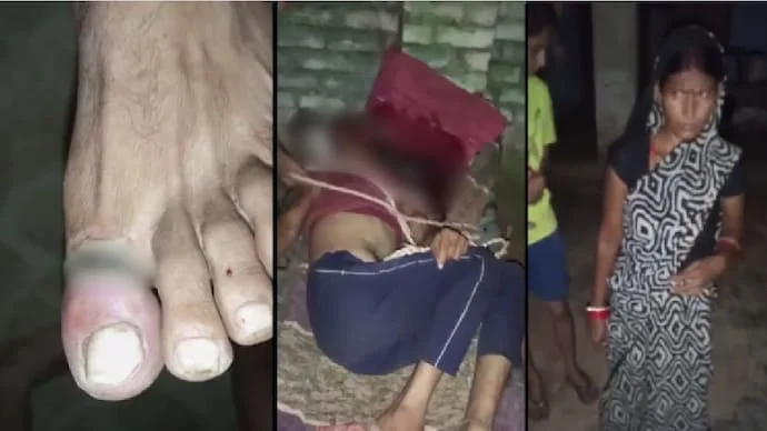 Uttar Pradesh Woman Accused of Torturing Husband with Electric Shocks